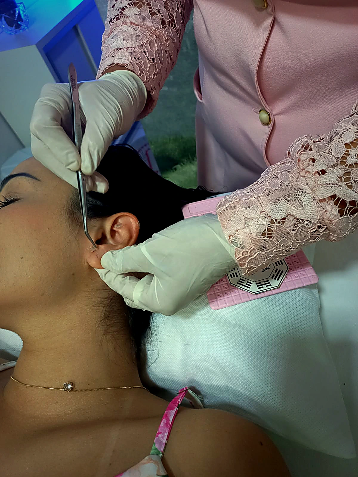 Acupuntura e Auriculoterapia no Alívio da Ansiedade em Rio Verde - GO